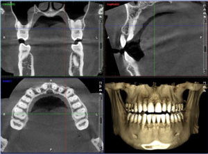 CT Scan 3D Technology