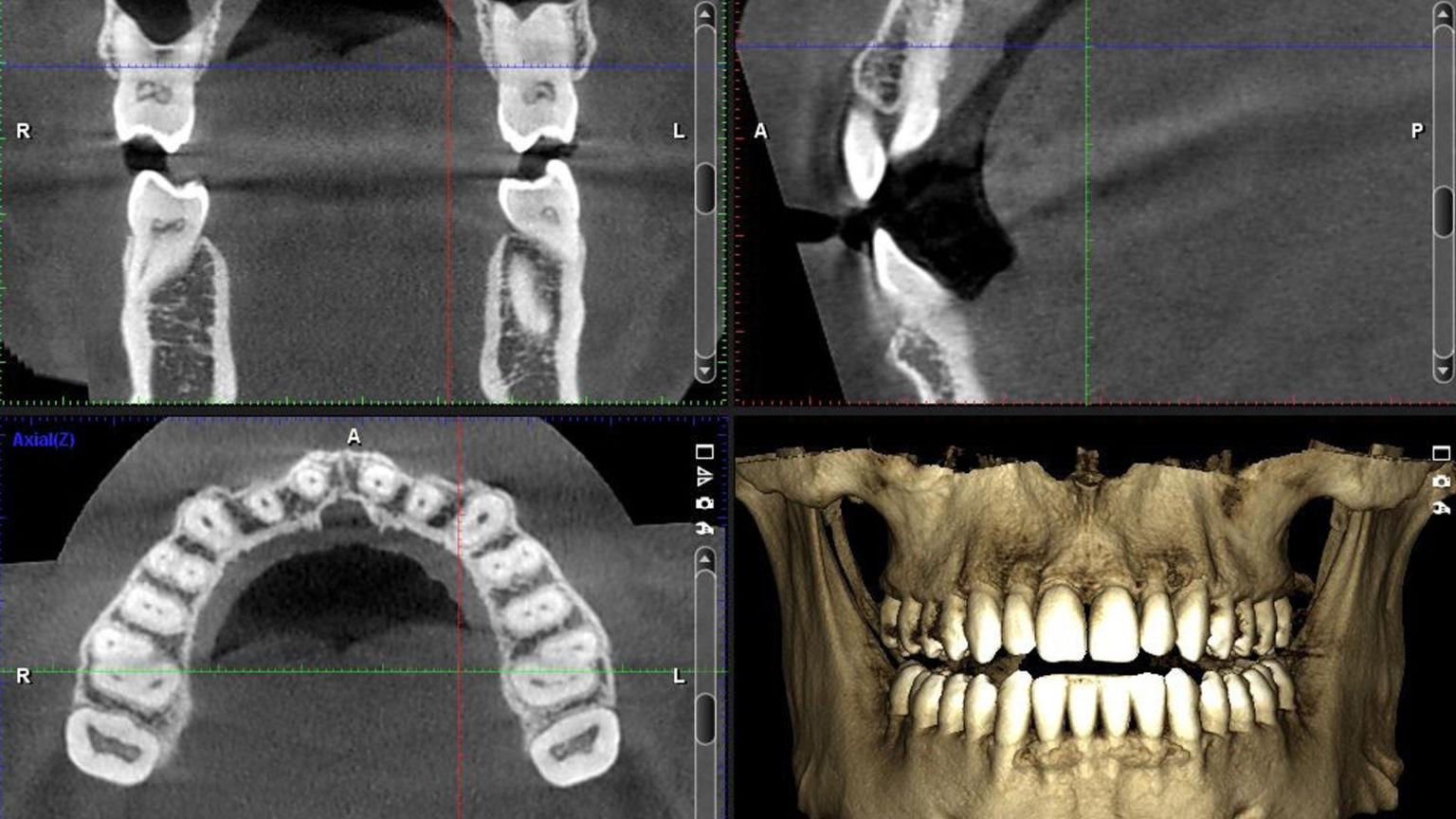 CT Scan 3D Technology | Mint Hill Dentistry | Dentist Charlotte NC