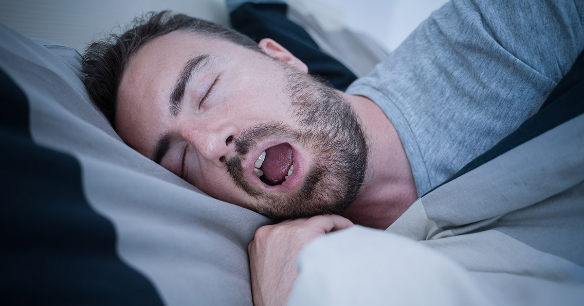 Sleep apnea oral appliances
