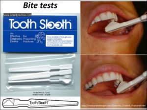 Tooth slooth